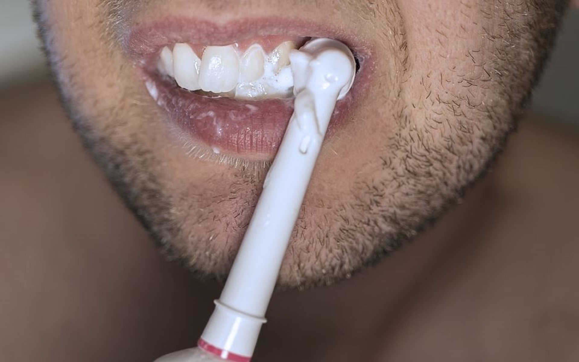 brosse à dents à tête ronde, la brosse électrique préferée des dentiste